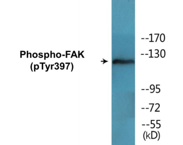 FAK (Phospho-Tyr397)Colorimetric Cell-Based ELISA Kit (CBCAB00252)