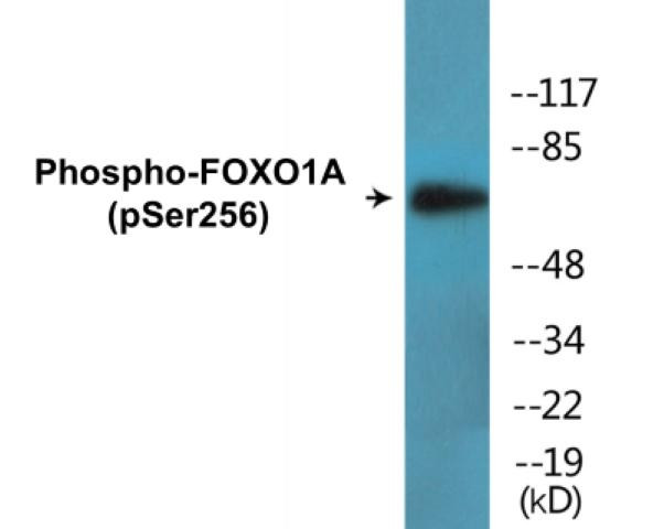 FOXO1A (Phospho-Ser256)Colorimetric Cell-Based ELISA Kit (CBCAB00253)