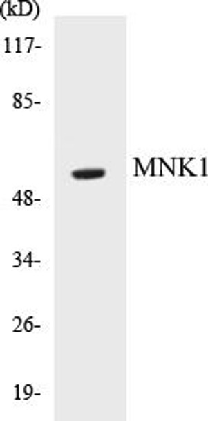 MNK1 Colorimetric Cell-Based ELISA Kit (CBCAB00333)
