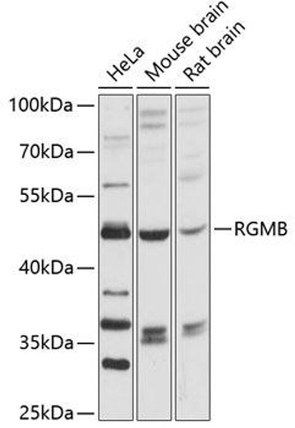 Anti-RGMB Antibody (CAB12859)