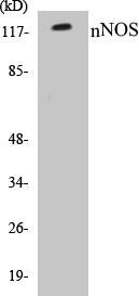 nNOS Colorimetric Cell-Based ELISA Kit (CBCAB00338)