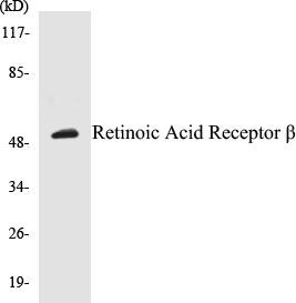 Retinoic Acid Receptor beta Colorimetric Cell-Based ELISA Kit (CBCAB00355)