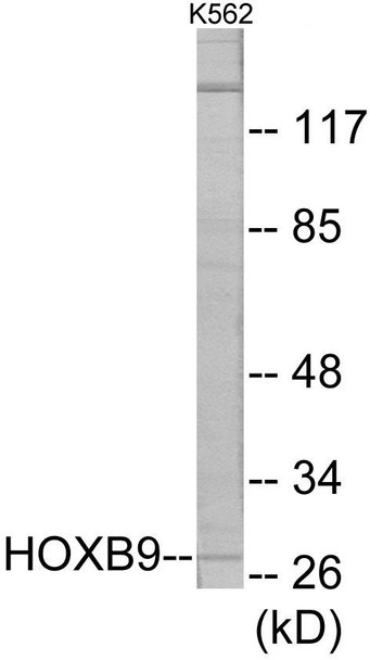 HOXB9 Colorimetric Cell-Based ELISA (CBCAB00378)