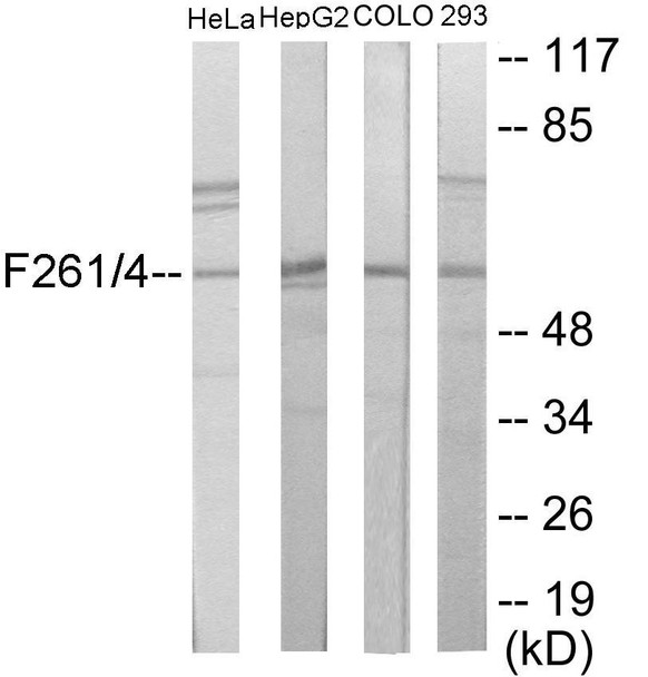PFKFB1/4 Colorimetric Cell-Based ELISA (CBCAB00386)