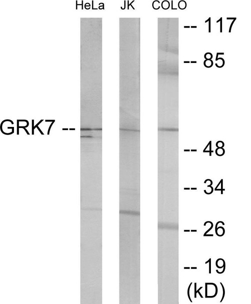 GRK7 Colorimetric Cell-Based ELISA (CBCAB00389)