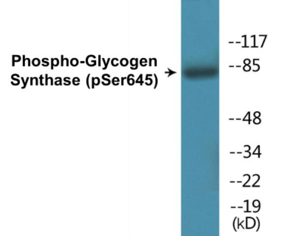 Glycogen Synthase (Phospho-Ser645)Colorimetric Cell-Based ELISA Kit (CBCAB00411)