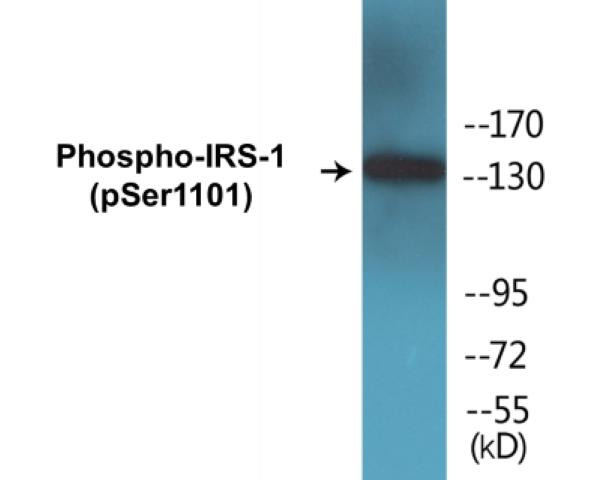 IRS-1 (Phospho-Ser1101)Colorimetric Cell-Based ELISA Kit (CBCAB00412)