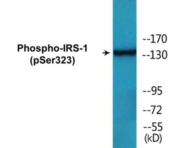 IRS-1 (Phospho-Ser323)Colorimetric Cell-Based ELISA Kit (CBCAB00420)