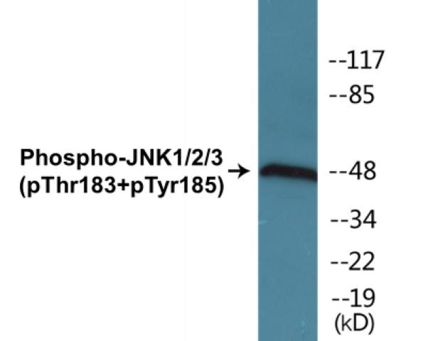 JNK1/2/3 (Phospho-Thr183+Tyr185)Colorimetric Cell-Based ELISA Kit (CBCAB00421)