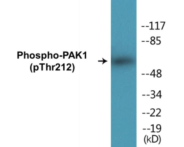 PAK1 (Phospho-Thr212)Colorimetric Cell-Based ELISA Kit (CBCAB00425)