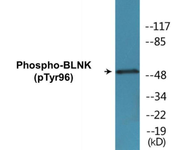 BLNK (Phospho-Tyr96)Colorimetric Cell-Based ELISA Kit (CBCAB00430)