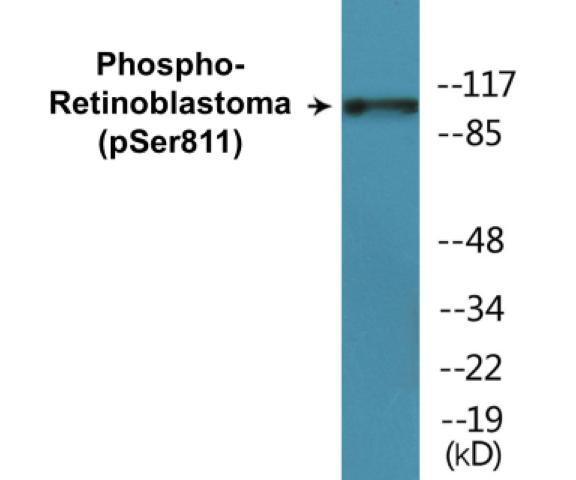 Retinoblastoma (Phospho-Ser811)Colorimetric Cell-Based ELISA Kit (CBCAB00440)