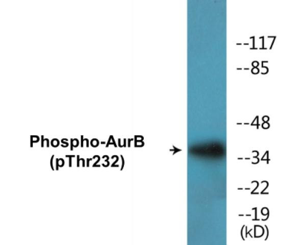 AurB (Phospho-Thr232)Colorimetric Cell-Based ELISA Kit (CBCAB00449)