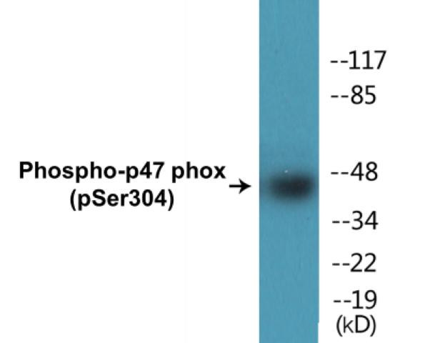 p47 phox (Phospho-Ser304)Colorimetric Cell-Based ELISA Kit (CBCAB00452)