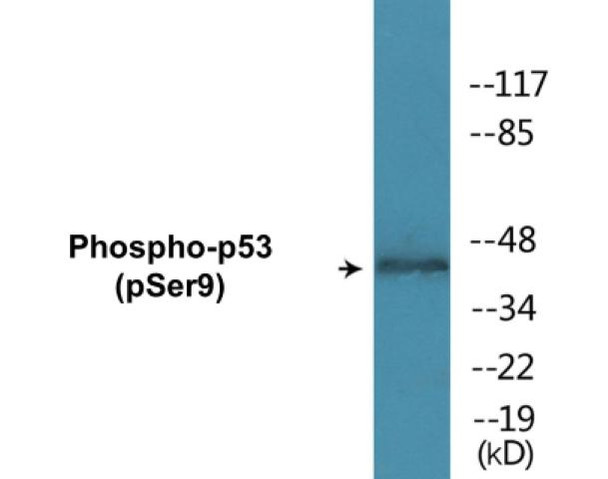 p53 (Phospho-Ser9)Colorimetric Cell-Based ELISA Kit (CBCAB00480)