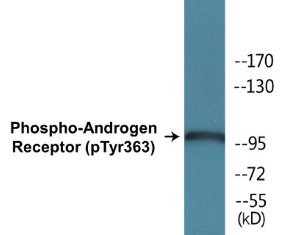 Androgen Receptor (Phospho-Tyr363)Colorimetric Cell-Based ELISA Kit (CBCAB00498)