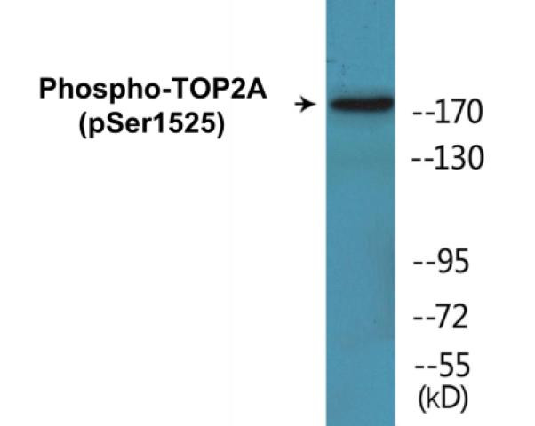 TOP2A (Phospho-Ser1525)Colorimetric Cell-Based ELISA Kit (CBCAB00503)