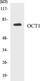 OCT1 Colorimetric Cell-Based ELISA Kit (CBCAB00506)