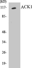 ACK1 Colorimetric Cell-Based ELISA Kit (CBCAB00512)