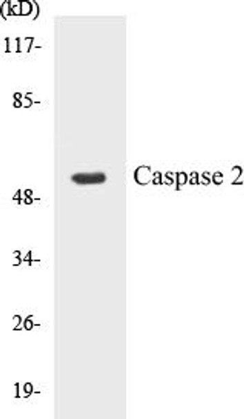 Caspase 2 Colorimetric Cell-Based ELISA Kit (CBCAB00564)