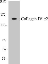 Collagen IV alpha2 Colorimetric Cell-Based ELISA Kit (CBCAB00592)
