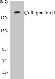 Collagen V alpha1 Colorimetric Cell-Based ELISA Kit (CBCAB00593)