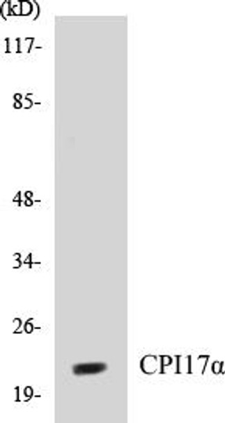 CPI17alpha Colorimetric Cell-Based ELISA Kit (CBCAB00596)