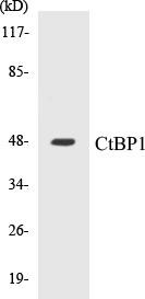 CtBP1 Colorimetric Cell-Based ELISA Kit (CBCAB00604)
