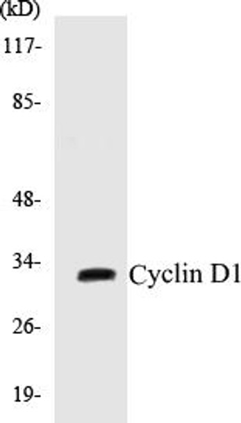 Cyclin D1 Colorimetric Cell-Based ELISA Kit (CBCAB00610)