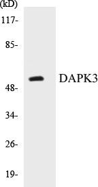 DAPK3 Colorimetric Cell-Based ELISA Kit (CBCAB00618)