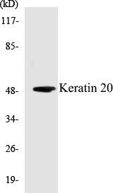 Keratin 20 Colorimetric Cell-Based ELISA Kit (CBCAB00727)