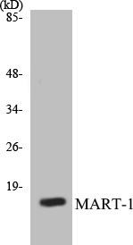 MART-1 Colorimetric Cell-Based ELISA Kit (CBCAB00746)