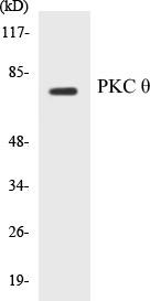 PKC theta Colorimetric Cell-Based ELISA Kit (CBCAB00819)