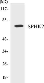 SPHK2 Colorimetric Cell-Based ELISA Kit (CBCAB00862)