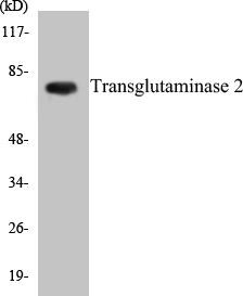 Transglutaminase 2 Colorimetric Cell-Based ELISA Kit (CBCAB00891)