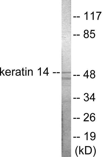 Keratin 14 Colorimetric Cell-Based ELISA (CBCAB00914)