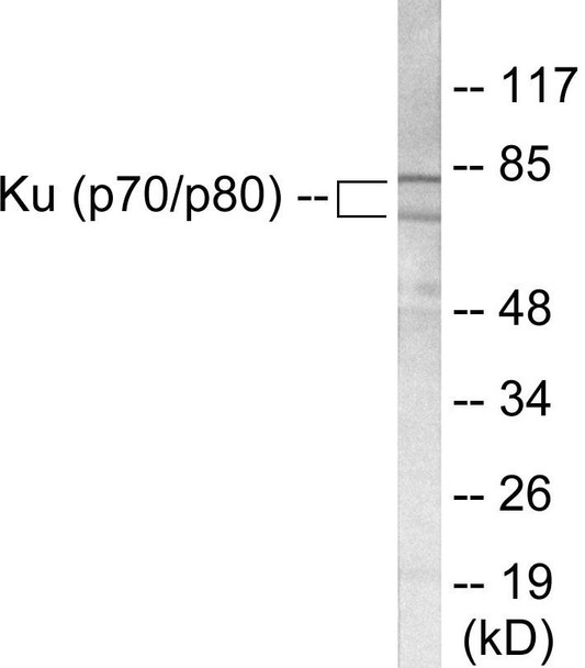 Ku70/80 Colorimetric Cell-Based ELISA (CBCAB00915)