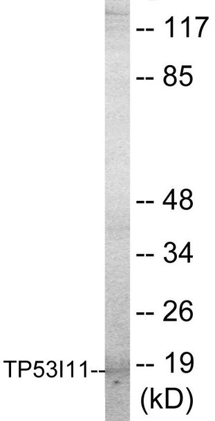 TP53I11 Colorimetric Cell-Based ELISA (CBCAB00924)