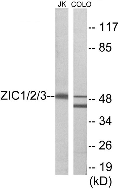 ZIC1/2/3 Colorimetric Cell-Based ELISA (CBCAB00940)