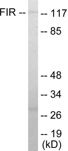 FIR Colorimetric Cell-Based ELISA (CBCAB00958)