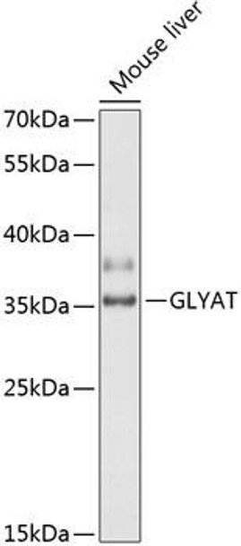 Anti-GLYAT Antibody (CAB14100)