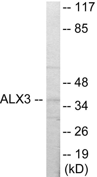 ALX3 Colorimetric Cell-Based ELISA (CBCAB00959)