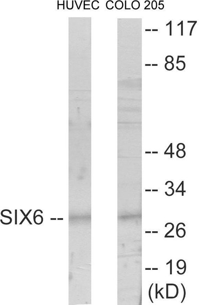 SIX6 Colorimetric Cell-Based ELISA (CBCAB00963)