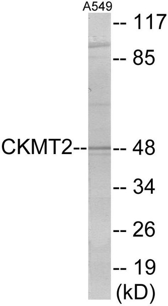 CKMT2 Colorimetric Cell-Based ELISA (CBCAB00978)