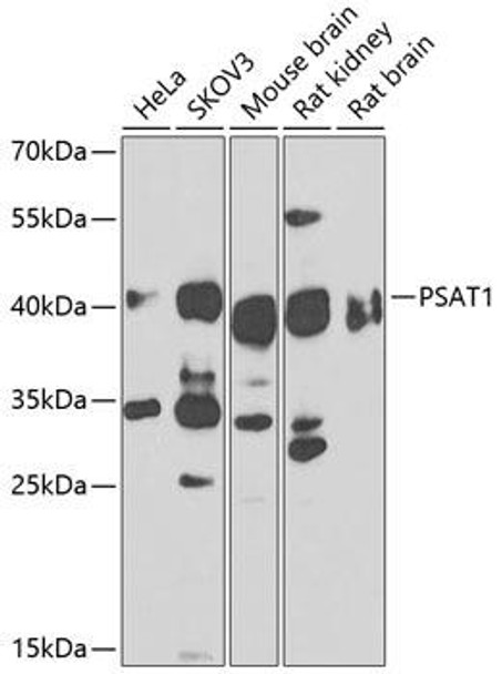Anti-PSAT1 Antibody (CAB14124)