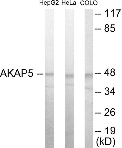 AKAP5 Colorimetric Cell-Based ELISA (CBCAB00992)
