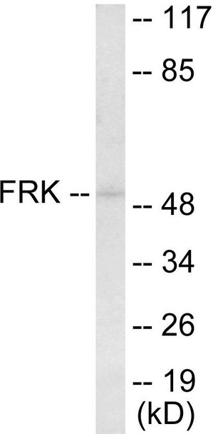 FRK Colorimetric Cell-Based ELISA (CBCAB01014)