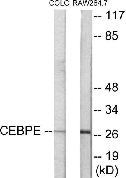 CEBPD/E Colorimetric Cell-Based ELISA (CBCAB01020)