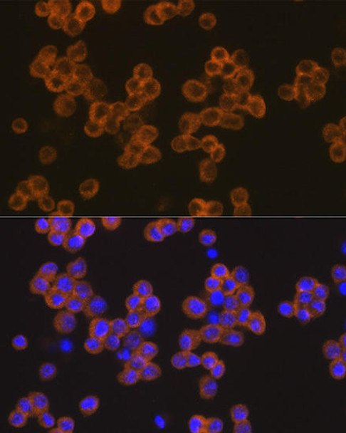 Anti-NLRP3 Antibody (CAB14223)
