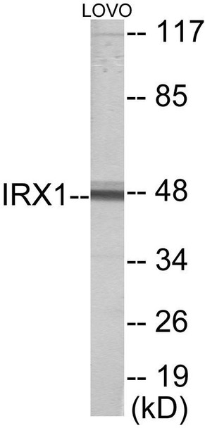 IRX1 Colorimetric Cell-Based ELISA (CBCAB01051)